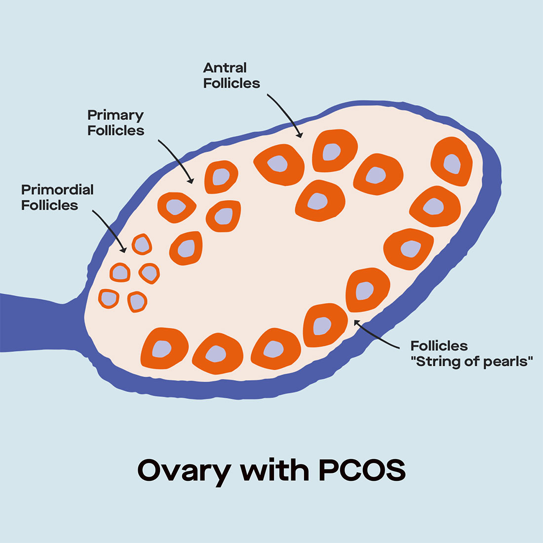 What are Some Common PCOS Tests Recommended for Diagnosis?