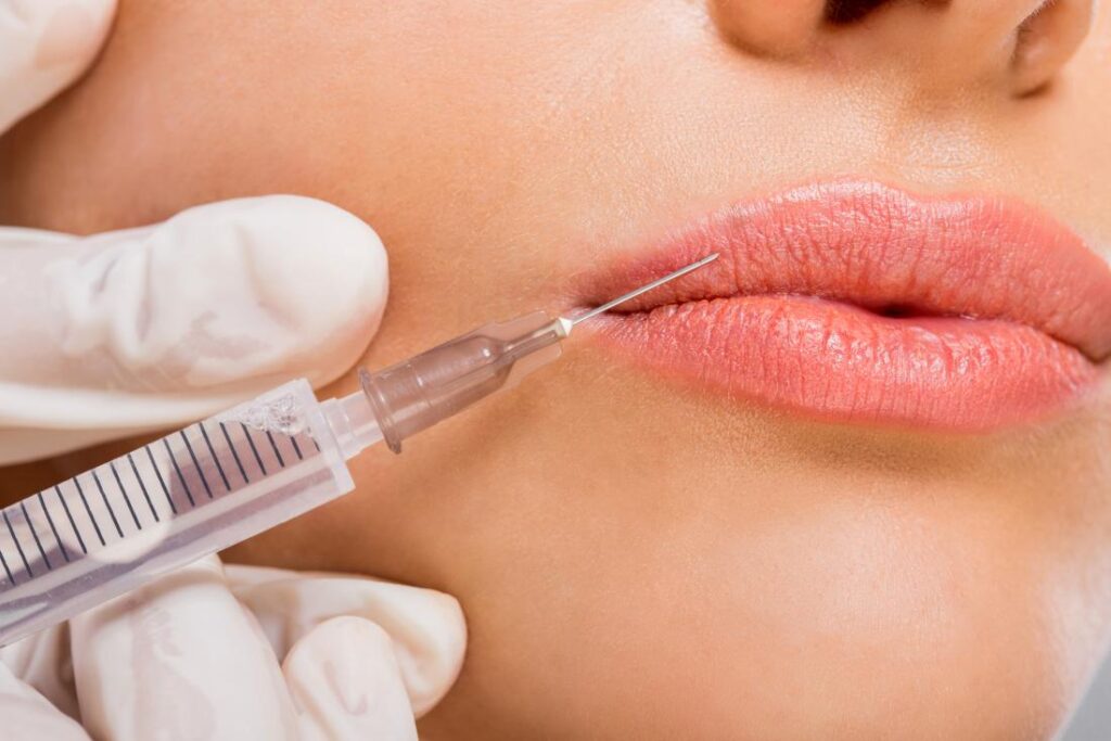 dermal fillers