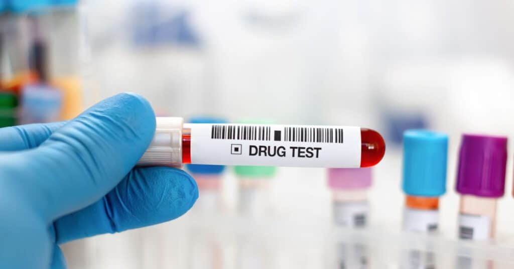 Marijuana Laws Impact Employer Drug Testing